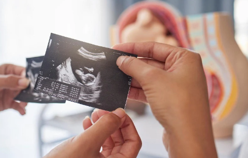 Top 5 IVF Questions Answered